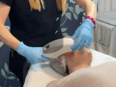 luz pulsada intensa fotorrejuvenecimiento arganda madrid