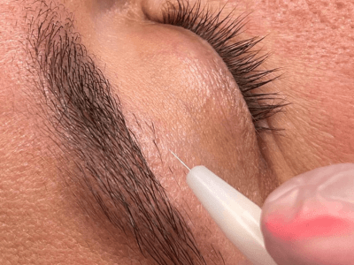 depilacion electrica definitiva arganda madrid