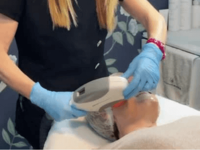 tratamiento facial luz pulsada intensiva arganda madrid