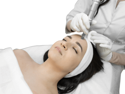 tratamiento microneedling acido hialuronico arganda madrid